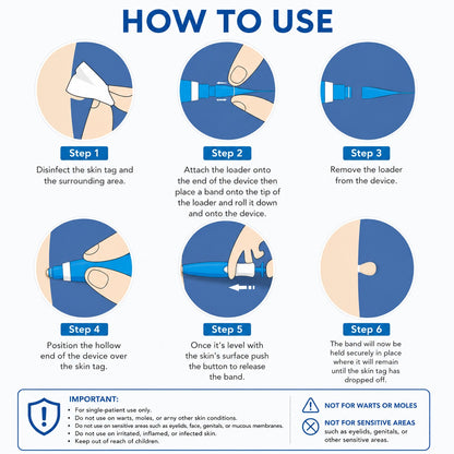 TagSmooth™ Skin Tag Removal Kit