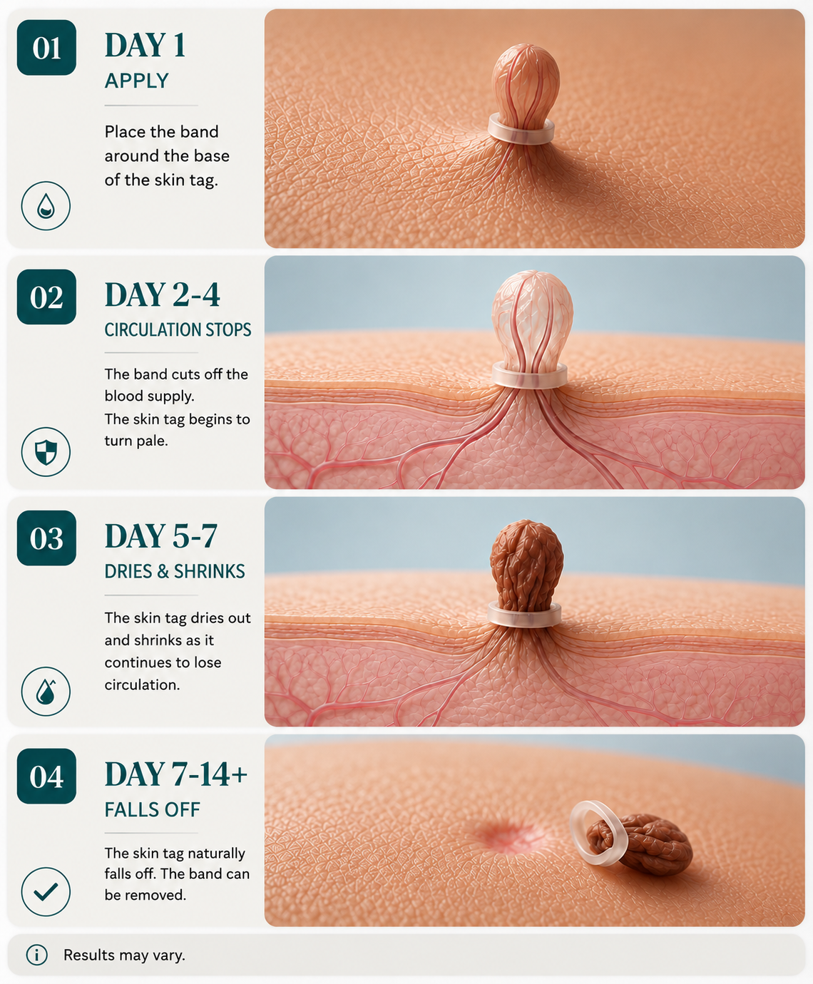 TagSmooth™ Skin Tag Removal Kit