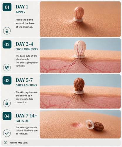 TagSmooth™ Skin Tag Removal Kit